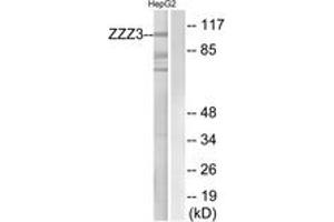 Western Blotting (WB) image for anti-Zinc Finger, ZZ-Type Containing 3 (ZZZ3) (AA 341-390) antibody (ABIN2890702) (ZZZ3 anticorps  (AA 341-390))
