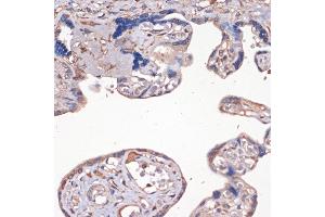 Immunohistochemistry of paraffin-embedded human placenta using IGF2 Rabbit pAb (ABIN3022872, ABIN3022873, ABIN3022874 and ABIN6219274) at dilution of 1:100 (40x lens). (IGF2 anticorps  (AA 25-180))