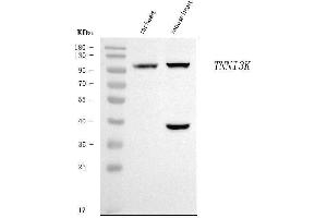Western blot analysis of TNNI3K using anti-TNNI3K antibody (ABIN7599644).