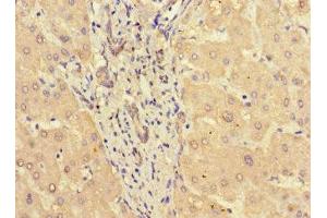 Immunohistochemistry of paraffin-embedded human liver tissue using ABIN7169675 at dilution of 1:100