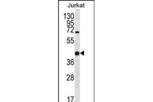 LGALS4 Antibody (N-term) (ABIN656325 and ABIN2845624) western blot analysis in Jurkat cell line lysates (35 μg/lane).