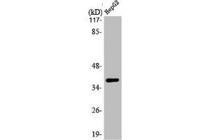Western Blot analysis of HepG2 cells using L-type Ca++ CP γ7 Polyclonal Antibody