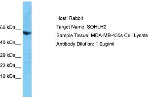 Host: Rabbit Target Name: SOHLH2 Sample Tissue: Human MDA-MB-435s Whole Cell Antibody Dilution: 1ug/ml (SOHLH2 anticorps  (N-Term))