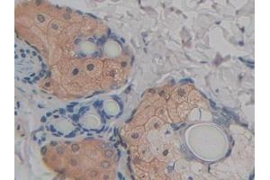 Detection of FABP9 in Rat Skin Tissue using Polyclonal Antibody to Fatty Acid Binding Protein 9, Testis (FABP9) (FABP9 anticorps  (AA 1-130))
