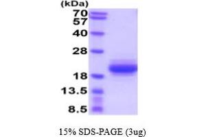 SDS-PAGE (SDS) image for Interleukin 31 (IL31) (AA 24-159) protein (His tag) (ABIN5854872)