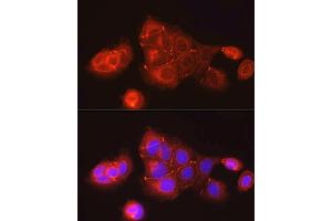 Immunofluorescence analysis of MCF7 cells using ZO-1 Rabbit pAb (ABIN1513706, ABIN3021026, ABIN3021027 and ABIN6213922) at dilution of 1:150 (40x lens). (TJP1 anticorps  (AA 1600-1700))