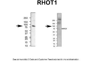 mouse brain and human neuroblastoma (RHOT1 anticorps  (N-Term))