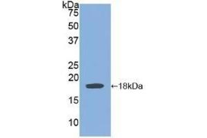Detection of Recombinant BMP15, Human using Polyclonal Antibody to Bone Morphogenetic Protein 15 (BMP15) (BMP15 anticorps  (AA 266-388))