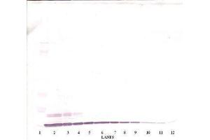 Image no. 3 for anti-Chemokine (C-X-C Motif) Ligand 6 (CXCL6) antibody (ABIN464968)