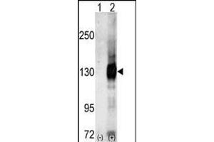 Western blot analysis of CASK (arrow) using Cask Antibody (C-term) (ABIN391318 and ABIN2841347). (CASK anticorps  (C-Term))