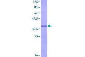 SDS-PAGE (SDS) image for G0/G1switch 2 (G0S2) (AA 1-103) protein (GST tag) (ABIN1354597)