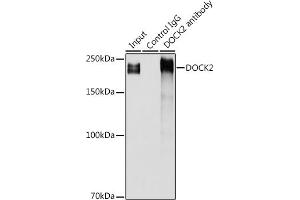 Immunoprecipitation analysis of 300 μg extracts of Jurkat cells using 3 μg DOCK2 antibody (ABIN1679578, ABIN5664348 and ABIN5664349).