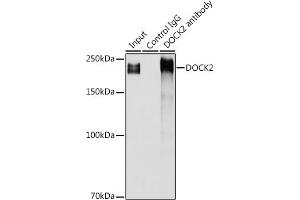Immunoprecipitation analysis of 300 μg extracts of Jurkat cells using 3 μg DOCK2 antibody (ABIN1679578, ABIN5664348 and ABIN5664349). (DOCK2 anticorps  (AA 1551-1830))