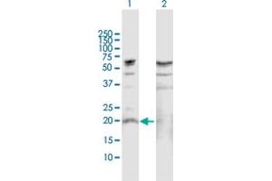Western Blot analysis of IL19 expression in transfected 293T cell line by IL19 MaxPab polyclonal antibody.
