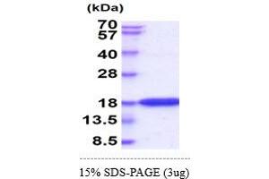SDS-PAGE (SDS) image for Interferon gamma (IFNG) (AA 24-161) (Active) protein (His tag) (ABIN6388155)