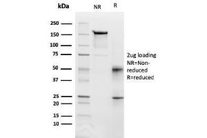 SDS-PAGE Analysis Purified CD95 Mouse Monoclonal Antibody (FAS/3112).