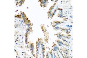 Immunohistochemistry of paraffin-embedded rat lung using BCKDK antibody (ABIN5974802) at dilution of 1/100 (40x lens). (BCKDK anticorps)