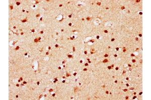 IHC image of nsucHU diluted at 1:10 and staining in paraffin-embedded human brain tissue performed on a Leica BondTM system.