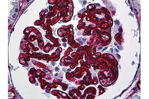 Anti-CD34 antibody IHC of human kidney, glomeruli. (CD34 anticorps)