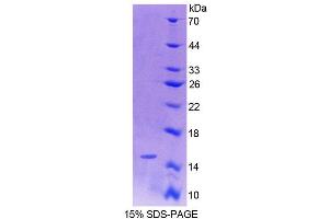 SDS-PAGE (SDS) image for Oxytocin, Prepropeptide (OXT) (AA 20-124) protein (His tag) (ABIN6239510)