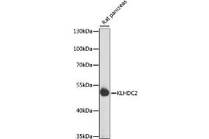 Western blot analysis of extracts of rat pancreas, using KLHDC2 antibody  at 1:1000 dilution. (KLHDC2 anticorps  (AA 1-240))