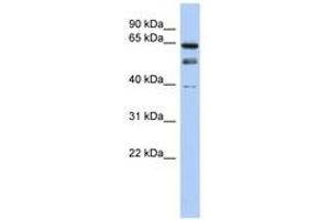 Image no. 1 for anti-MYST Histone Acetyltransferase 2 (MYST2) (N-Term) antibody (ABIN6740262) (MYST2 anticorps  (N-Term))