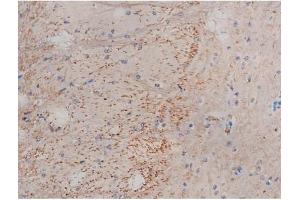 ABIN6267353 at 1/200 staining Mouse brain tissue sections by IHC-P. (MAPT anticorps  (pSer214))