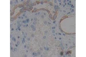 IHC-P analysis of Human Tissue, with DAB staining. (PLXNB1 anticorps  (AA 1780-2042))