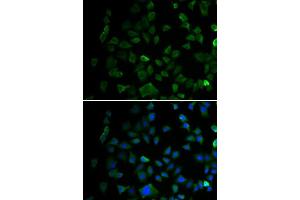 Immunofluorescence analysis of U2OS cells using MAP2K1 antibody.