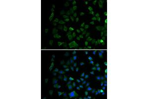 Immunofluorescence analysis of U2OS cells using MAP2K1 antibody. (MEK1 anticorps  (AA 1-100))