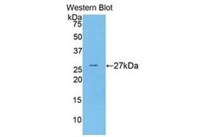 Western Blotting (WB) image for anti-Coagulation Factor IX (F9) (AA 241-463) antibody (ABIN1858772) (Coagulation Factor IX anticorps  (AA 241-463))