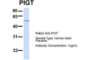 Host:  Rabbit  Target Name:  PIGT  Sample Type:  Human Adult Placenta  Antibody Dilution:  1. (PIGT anticorps  (C-Term))
