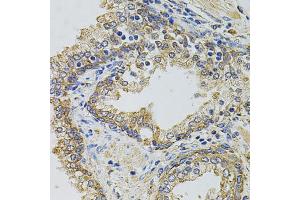 Immunohistochemistry of paraffin-embedded human prostate using GM13125 antibody.