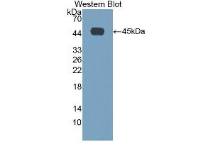 Detection of Recombinant IL4, Mouse using Polyclonal Antibody to Interleukin 4 (IL4) (IL-4 anticorps  (AA 21-140))