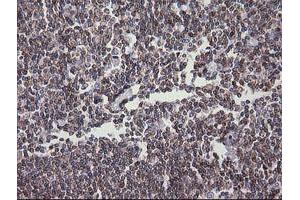 Image no. 1 for anti-Differentially Expressed in FDCP 6 Homolog (DEF6) antibody (ABIN1497809) (DEF6 anticorps)