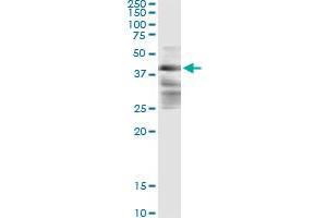 Immunoprecipitation of ZFYVE19 transfected lysate using anti-ZFYVE19 monoclonal antibody and Protein A Magnetic Bead , and immunoblotted with ZFYVE19 MaxPab rabbit polyclonal antibody. (ZFYVE19 anticorps  (AA 1-396))
