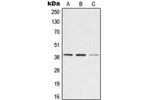 Western blot analysis of ZADH2 expression in Jurkat (A), Raw264.