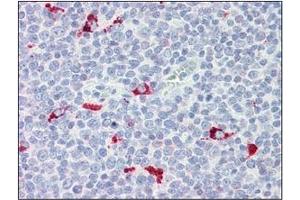Immunohistochemistry (IHC) image for anti-Interferon Regulatory Factor 7 (IRF7) (AA 1-150), (N-Term) antibody (ABIN263914)