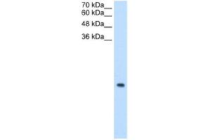 WB Suggested Anti-MRPS12 Antibody Titration:  0. (MRPS12 anticorps  (N-Term))