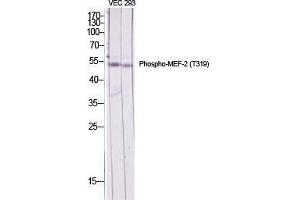 Western Blot (WB) analysis of specific cells using Phospho-MEF-2 (T319) Polyclonal Antibody.