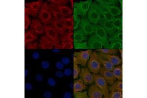 ABIN6257505 and ABIN6276213 staining Hela cells by IF/ICC. (SCTR anticorps  (Internal Region))