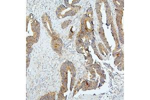 IHC analysis of BUB1B using anti-BUB1B antibody (ABIN7600962). (BUB1B anticorps  (AA 26-448))
