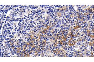 Detection of CD23 in Human Amygdalitis Tissue using Polyclonal Antibody to Cluster Of Differentiation 23 (CD23) (FCER2 anticorps  (AA 151-321))