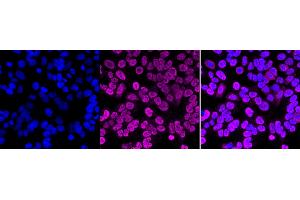 Immunocytochemical staining of HAP-1 cells with PTBP1 antibody (ABIN7799882), 1:1,000). (Recombinant PTBP1 anticorps)