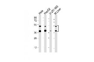 All lanes : Anti-FDPS Antibody (Center) at 1:2000-1:4000 dilution Lane 1: Hela whole cell lysate Lane 2: HepG2 whole cell lysate Lane 3: U-251 MG whole cell lysate Lane 4: Mouse Liver lysate Lysates/proteins at 20 μg per lane.
