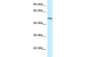 WB Suggested Anti-ZFP2 Antibody Titration: 1. (ZFP2 anticorps  (N-Term))