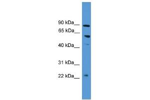 WB Suggested Anti-PDZK1 Antibody Titration:  0.