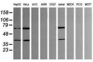 Image no. 1 for anti-tRNA Methyltransferase 2 Homolog A (TRMT2A) antibody (ABIN1501515) (TRMT2A anticorps)