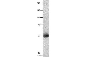 Western blot analysis of Human ovarian cancer tissue, using DRD5 Polyclonal Antibody at dilution of 1:800 (DRD5 anticorps)