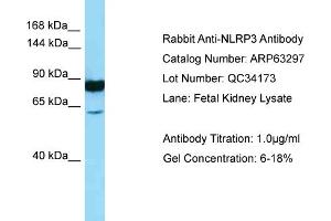 Western Blotting (WB) image for anti-NLR Family, Pyrin Domain Containing 3 (NLRP3) (N-Term) antibody (ABIN2789437) (NLRP3 anticorps  (N-Term))
